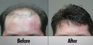 Sure Hair International- Before & After- Old Quebec Street Shoppes